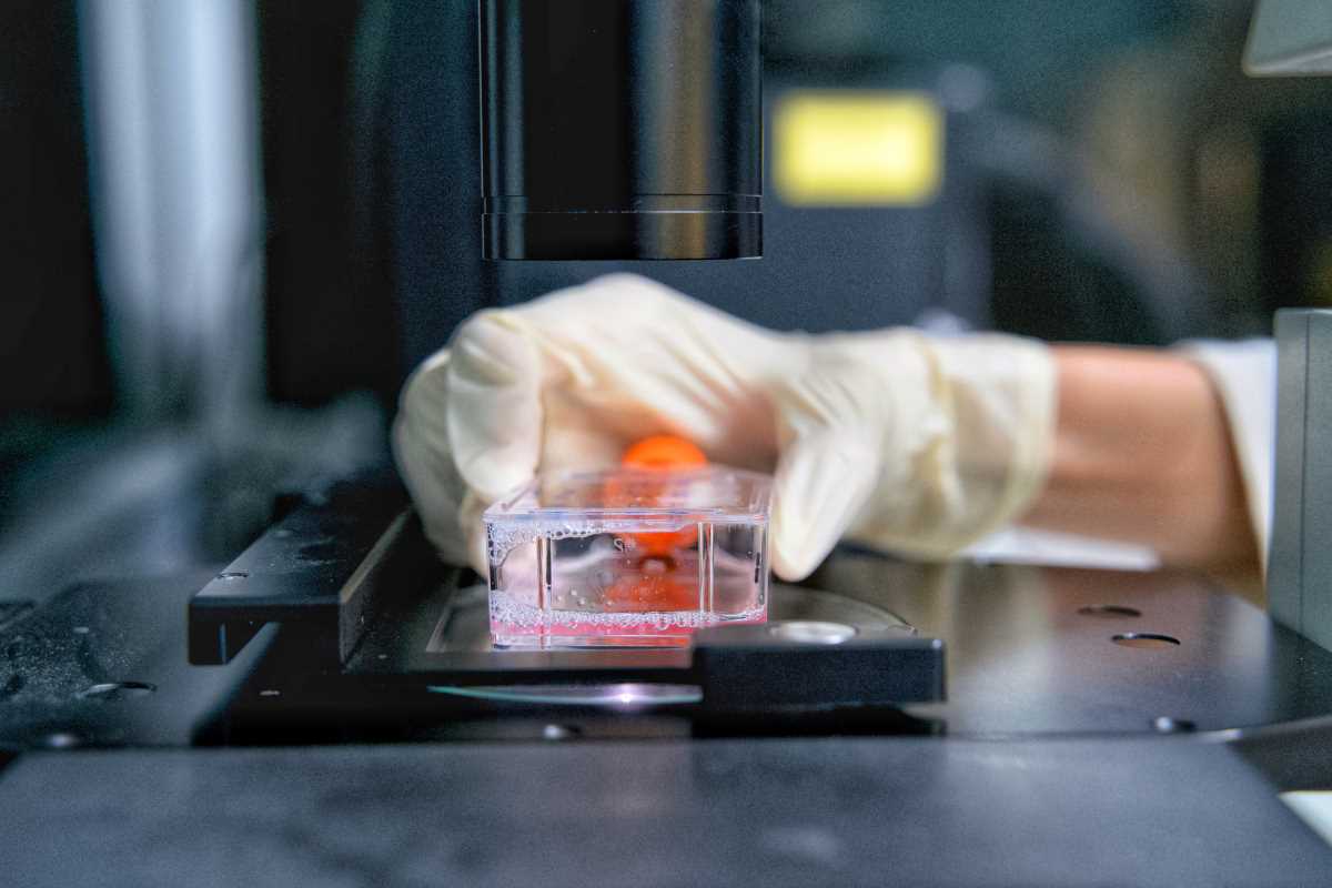 Stem Cell Progress in Regenerative Health